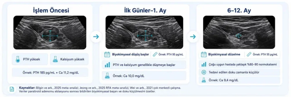 Paratiroid adenomu ablasyonu sonrası PTH ve kalsiyum düzeylerinin işlem öncesi, ilk günler ve 6-12. ay karşılaştırması