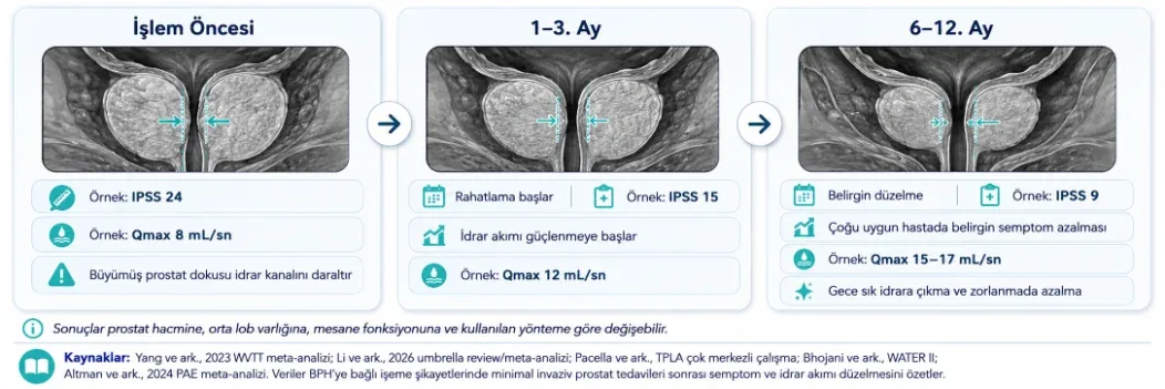 Prostat ablasyonu sonrası işlem öncesi, 1-3. ay ve 6-12. ay kontrol karşılaştırması