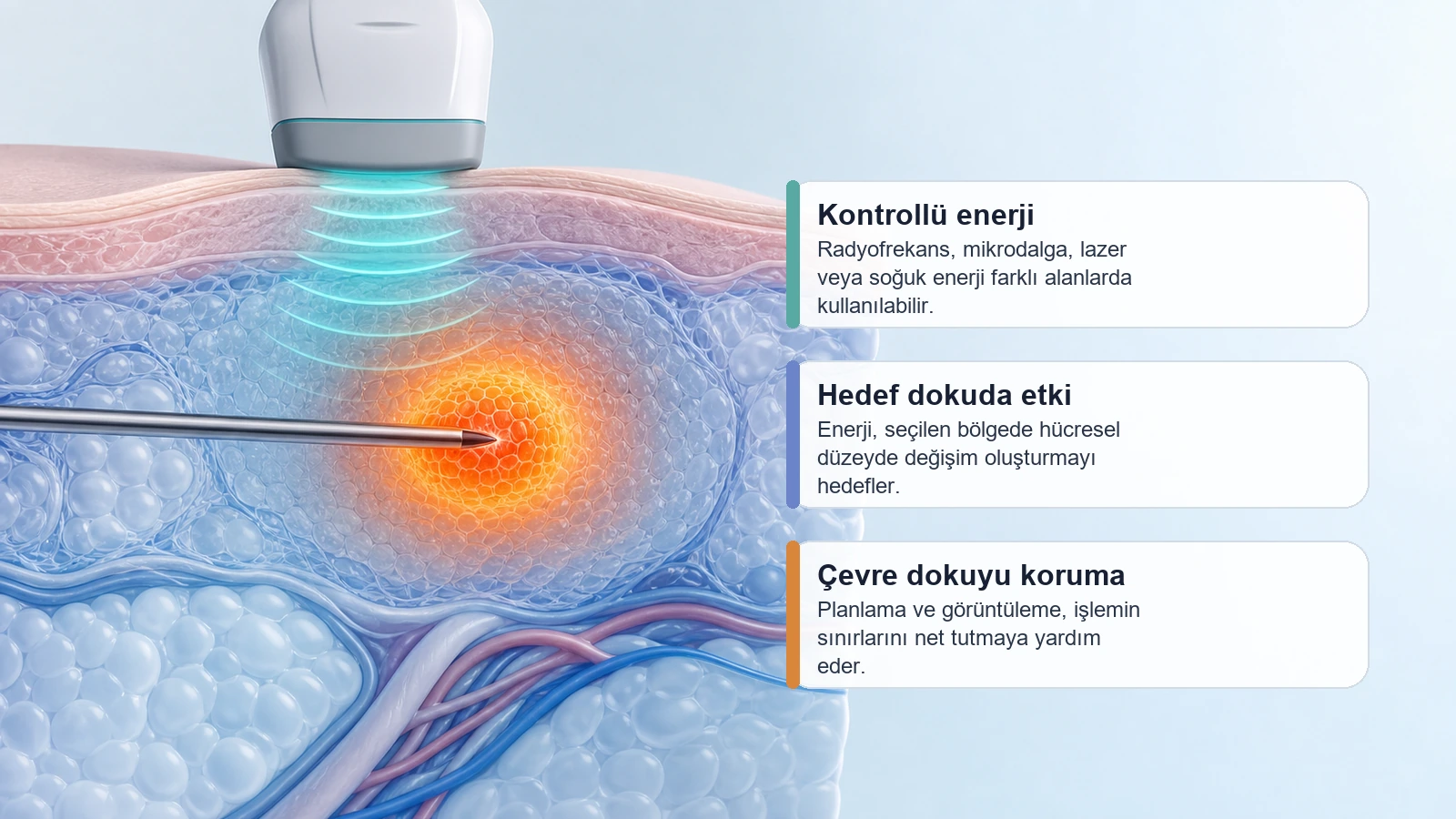 Ablasyonda kontrollü enerjinin hedef dokuda nasıl etki oluşturduğunu anlatan premium medikal görsel