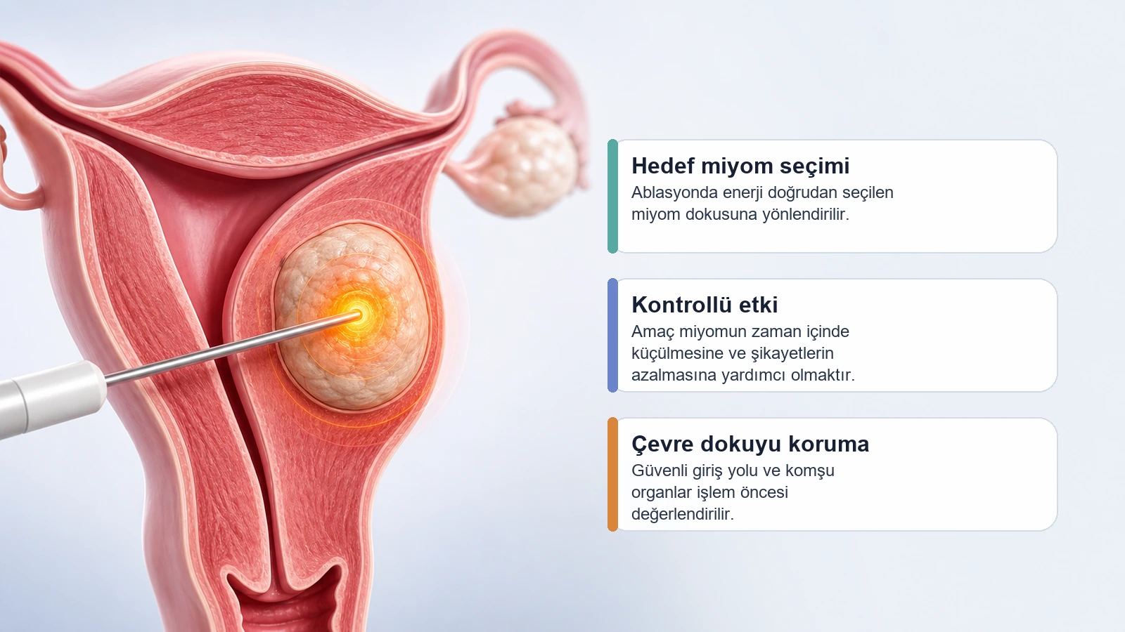 Miyom ablasyonunda kontrollü enerjinin hedef miyom dokusuna uygulanmasını gösteren premium medikal görsel