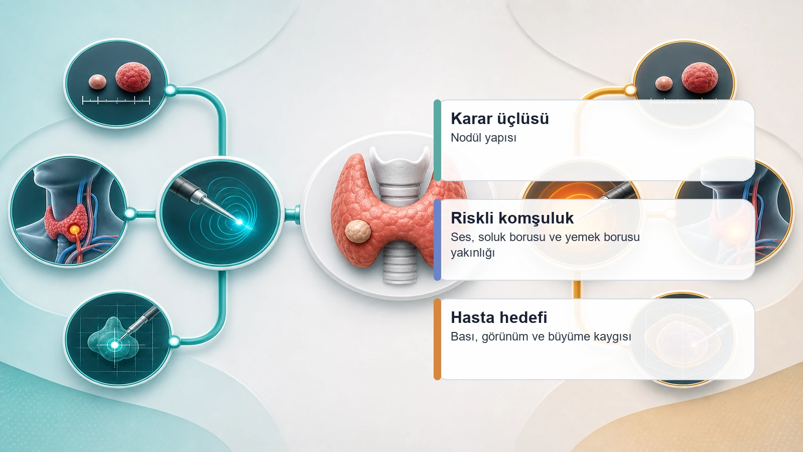 Tiroid nodül ablasyonunda radyofrekans veya mikrodalga seçimini nodül yapısı, riskli komşuluk ve hasta hedefi üzerinden gösteren karar diyagramı