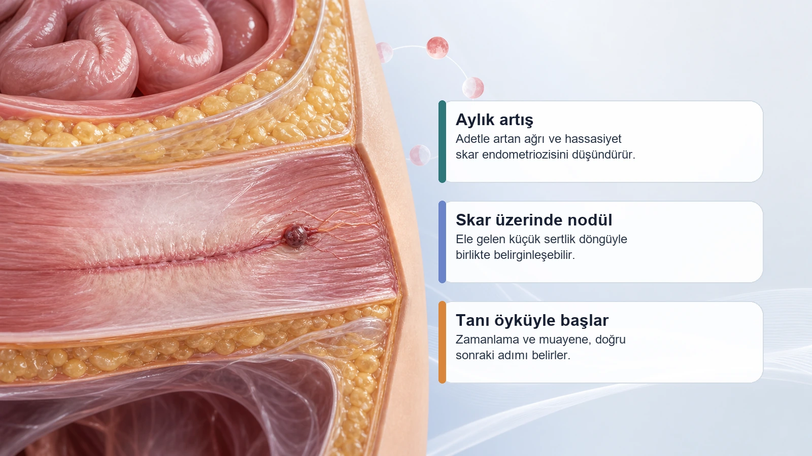 Adet Döneminde Sezeryan Skar Yerinde Ağrı Neden Olur? için aylik donemle artan sezaryen skar agrisini ve cilt altindaki odagi açıklayan premium medikal görsel