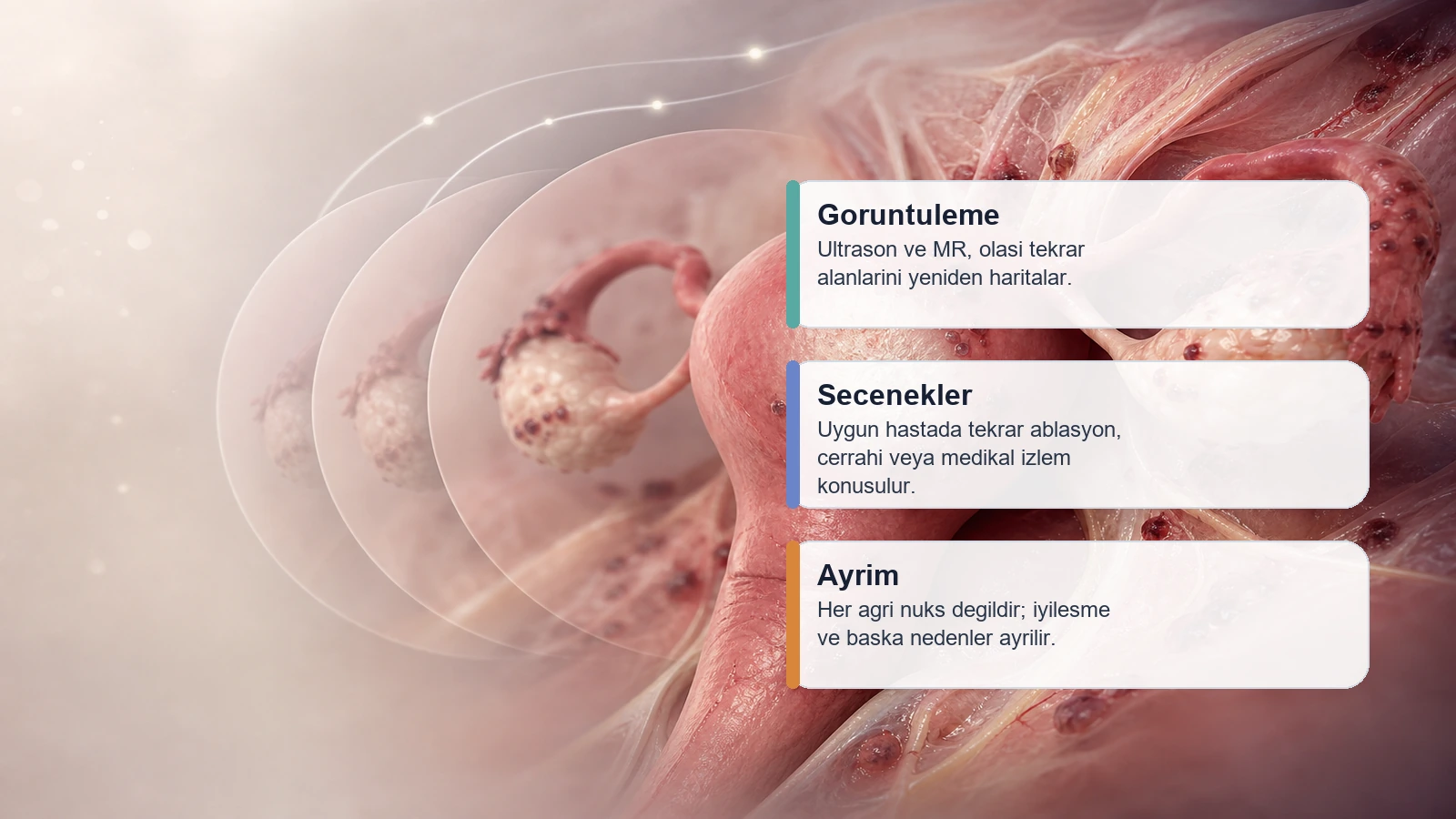 Endometriozis Ablasyonu Sonrasi Tekrarlar mi? icin goruntuleme, takip ve yeniden tedavi seceneklerini anlatan premium medikal gorsel