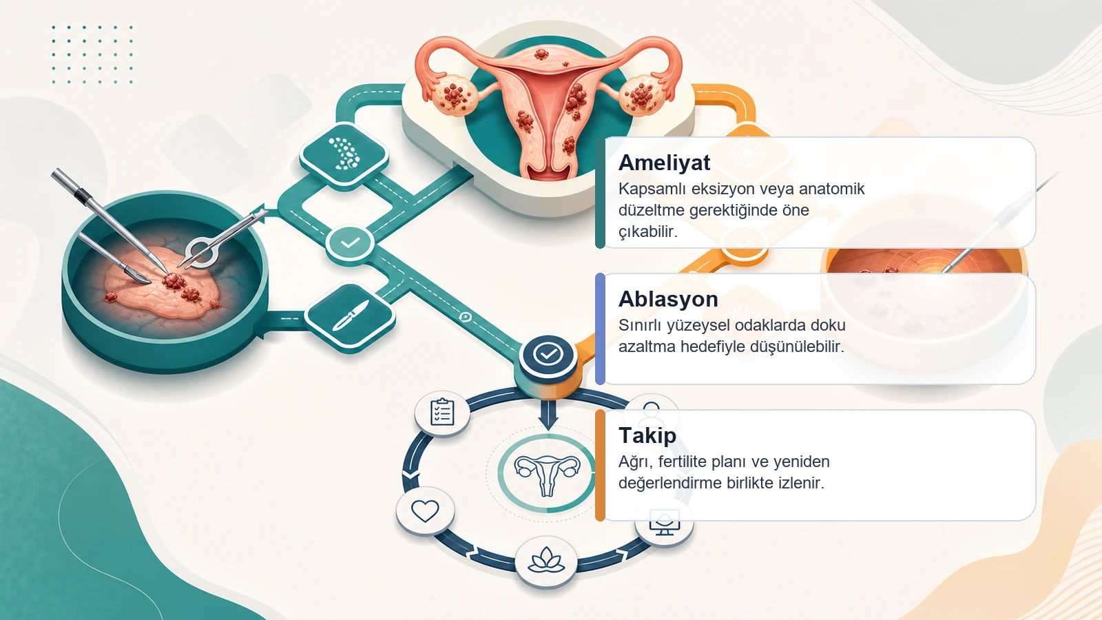 Endometriozis Ameliyat mı, Ablasyon mu? için ameliyat, ablasyon ve takip arasındaki karar yolunu açıklayan premium medikal görsel
