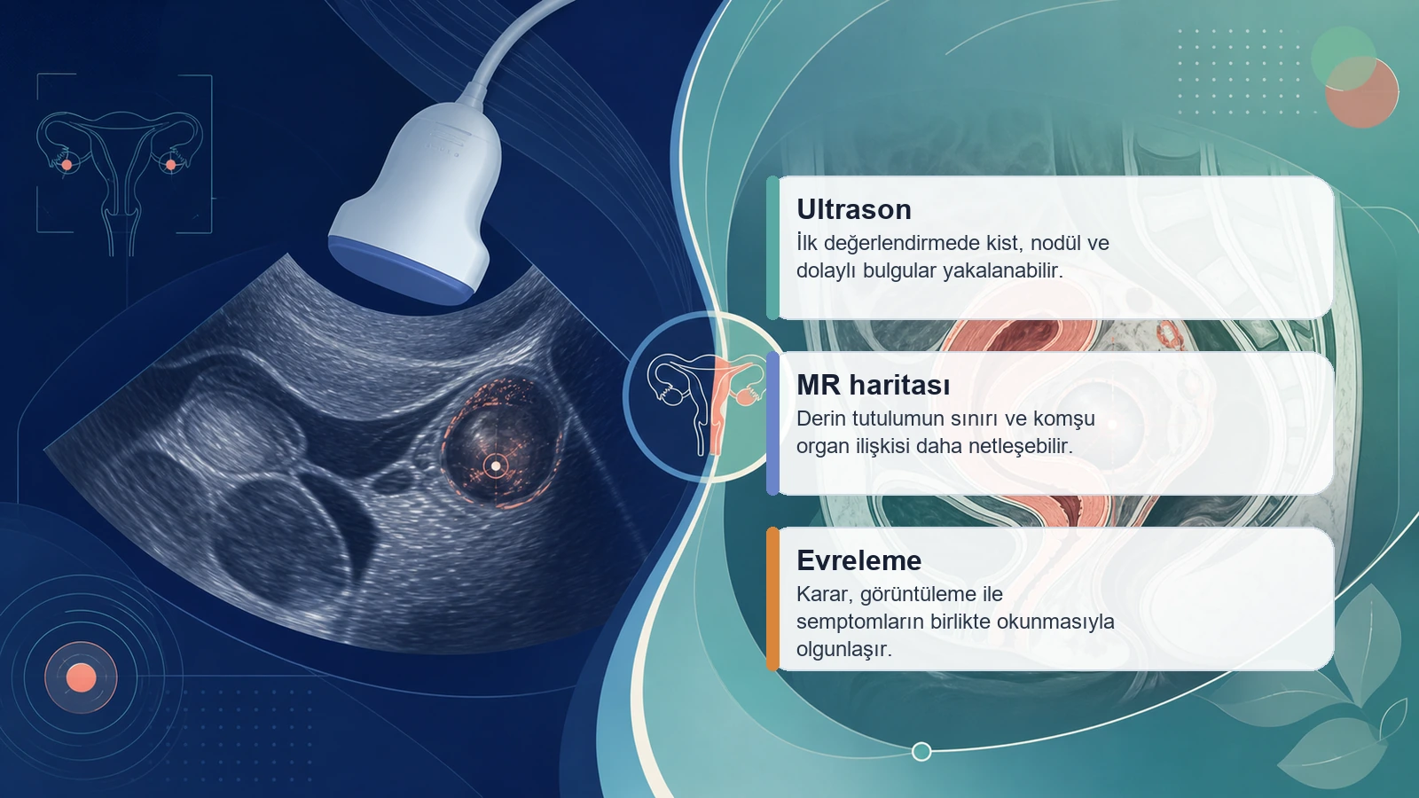 Endometriozis Ameliyat mı, Ablasyon mu? için ultrason ve MR ile endometriozis haritalamasini ve tutulum derinliğini açıklayan premium medikal görsel