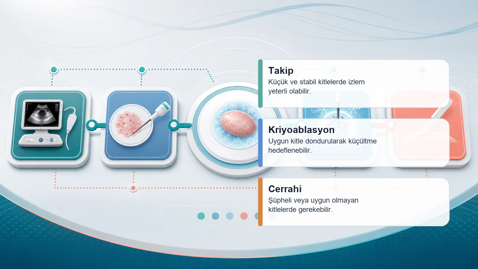 Fibroadenomda takip, kriyoablasyon ve cerrahi seçeneklerini karşılaştıran premium karar süreci görseli