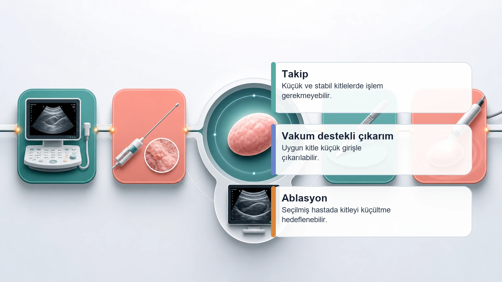 Meme fibroadenomunda takip, vakum destekli çıkarım ve ablasyon seçeneklerini karşılaştıran premium karar süreci görseli