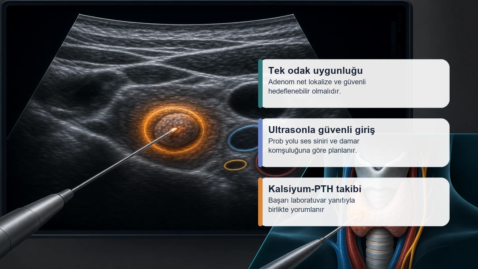 Paratiroid adenom mikrodalga ablasyonu için hedefleme, ultrason güvenliği ve kalsiyum PTH takibini açıklayan medikal görsel