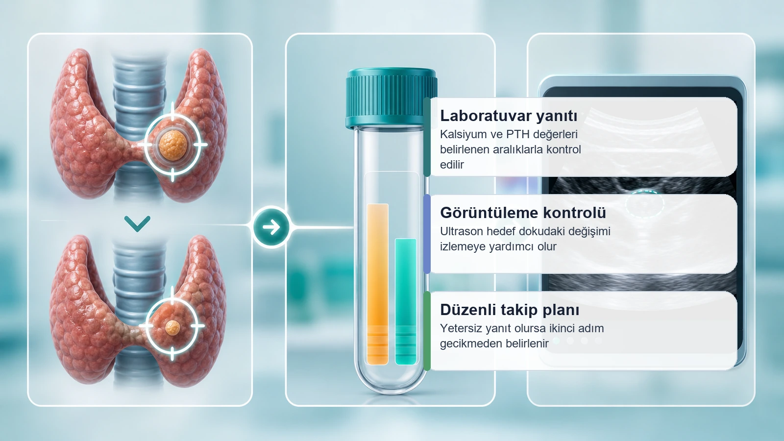 Paratiroid adenom mikrodalga ablasyonu sonrası kalsiyum PTH ve ultrason takibini açıklayan görsel