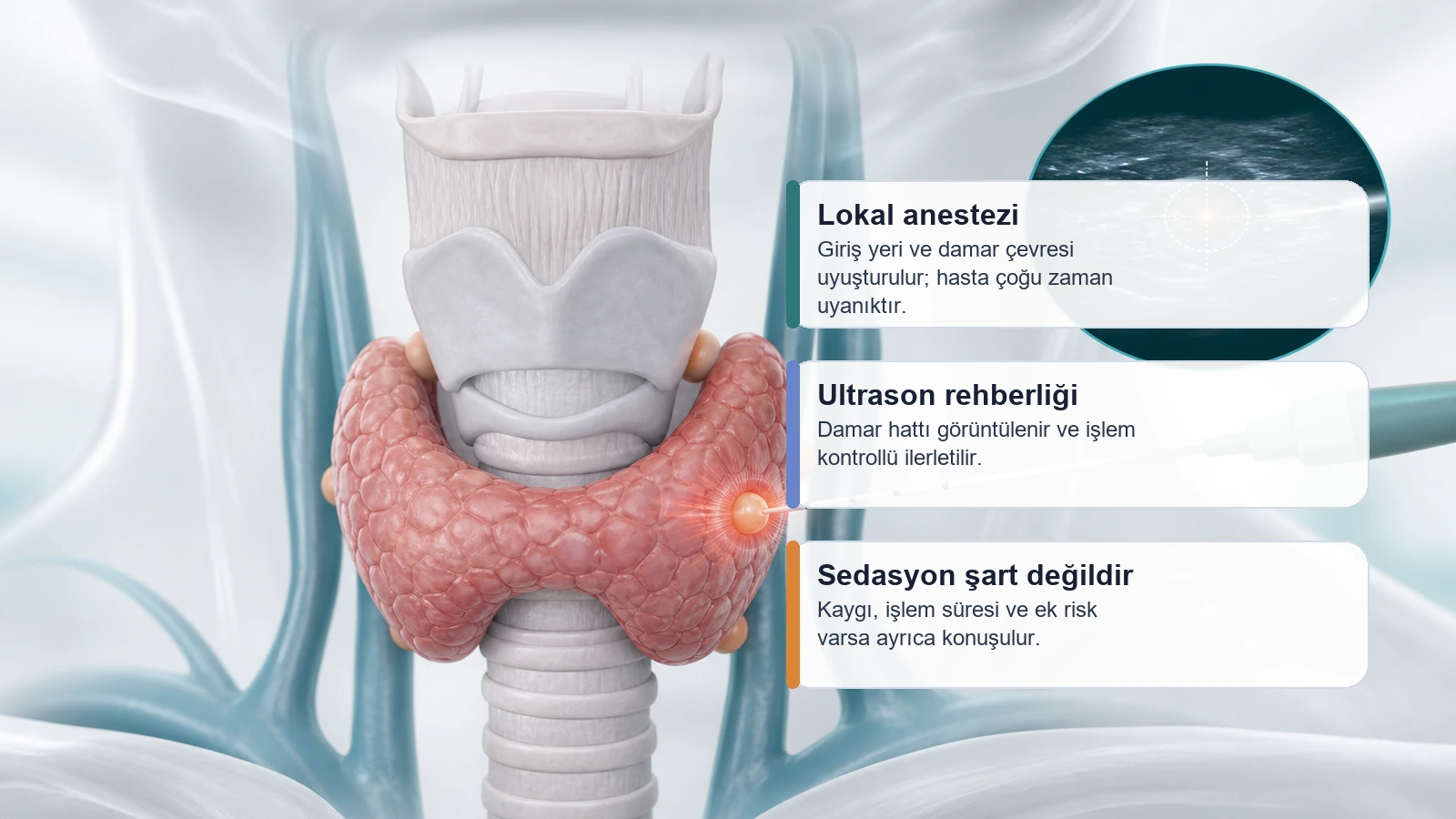 Paratiroid Adenom Radyofrekans Ablasyonu için lokal anestezi, ultrason rehberliği ve sedasyon kararını açıklayan premium medikal görsel