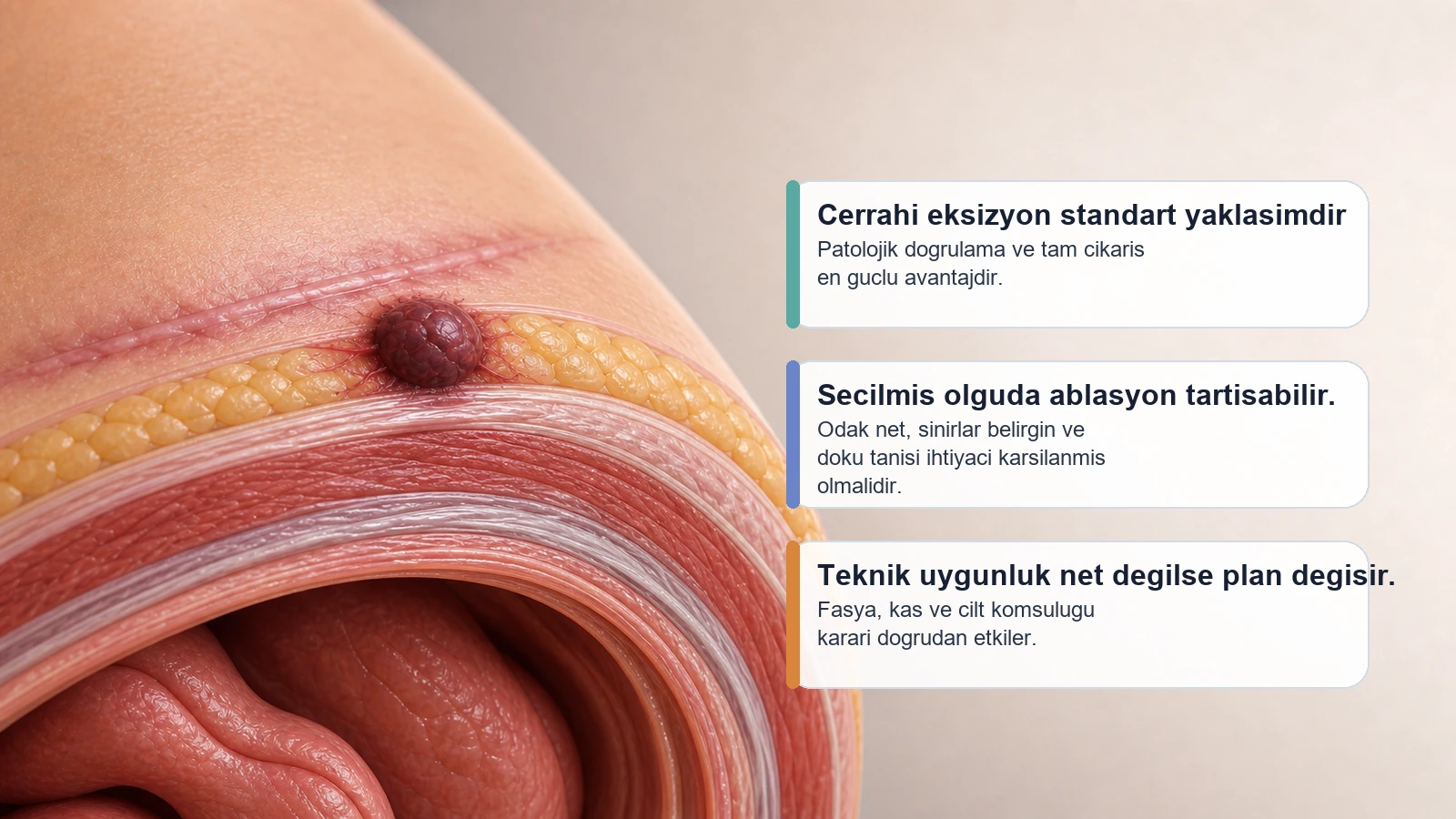 Sezaryen skarı endometriozisi tedavisinde cerrahi ve secilmis minimal girisimsel secenekleri anlatan premium gorsel