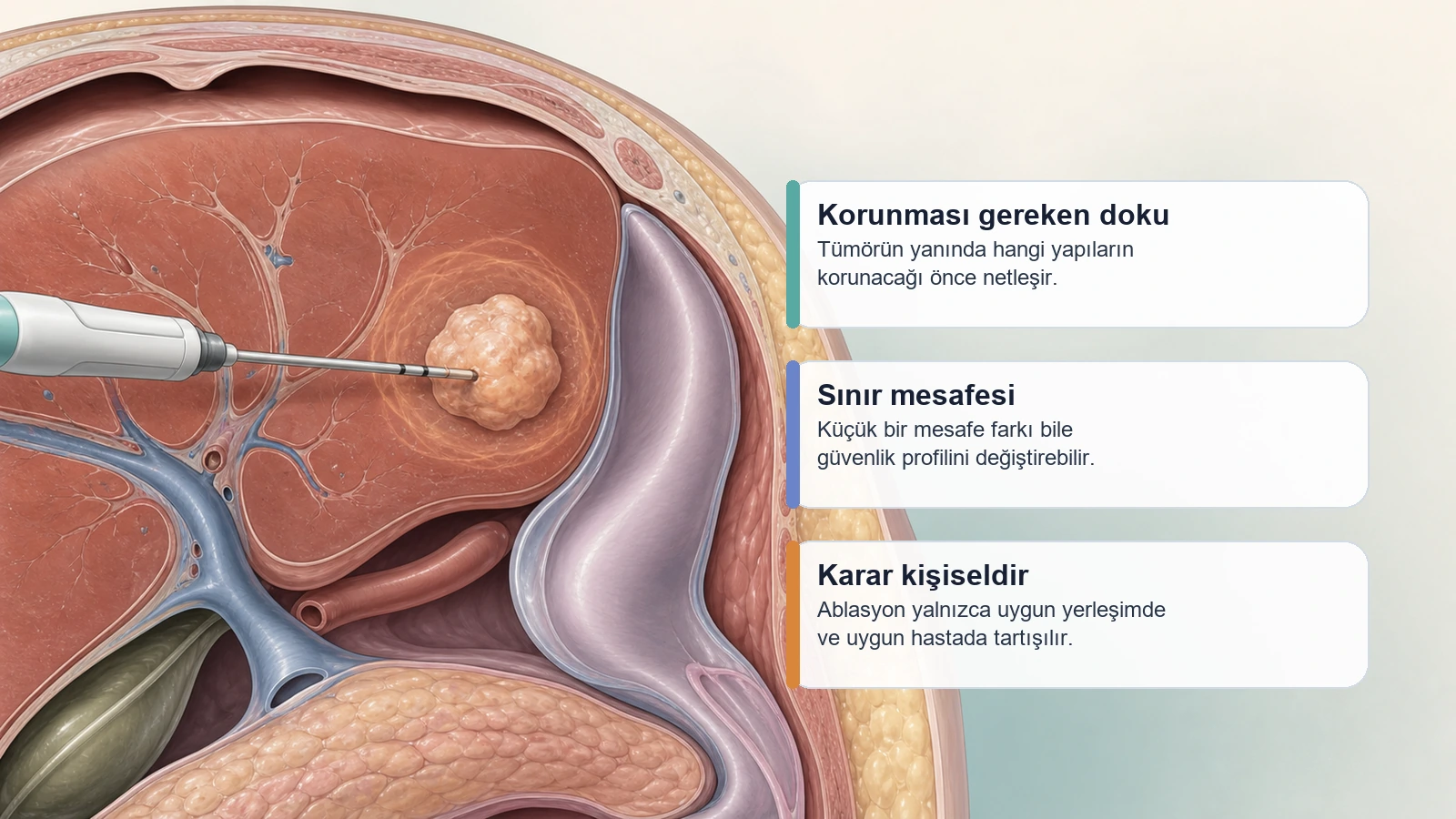 Tümör Ablasyonu Riskleri için tümör çevresindeki sınır ve güvenlik mesafelerini açıklayan premium medikal görsel