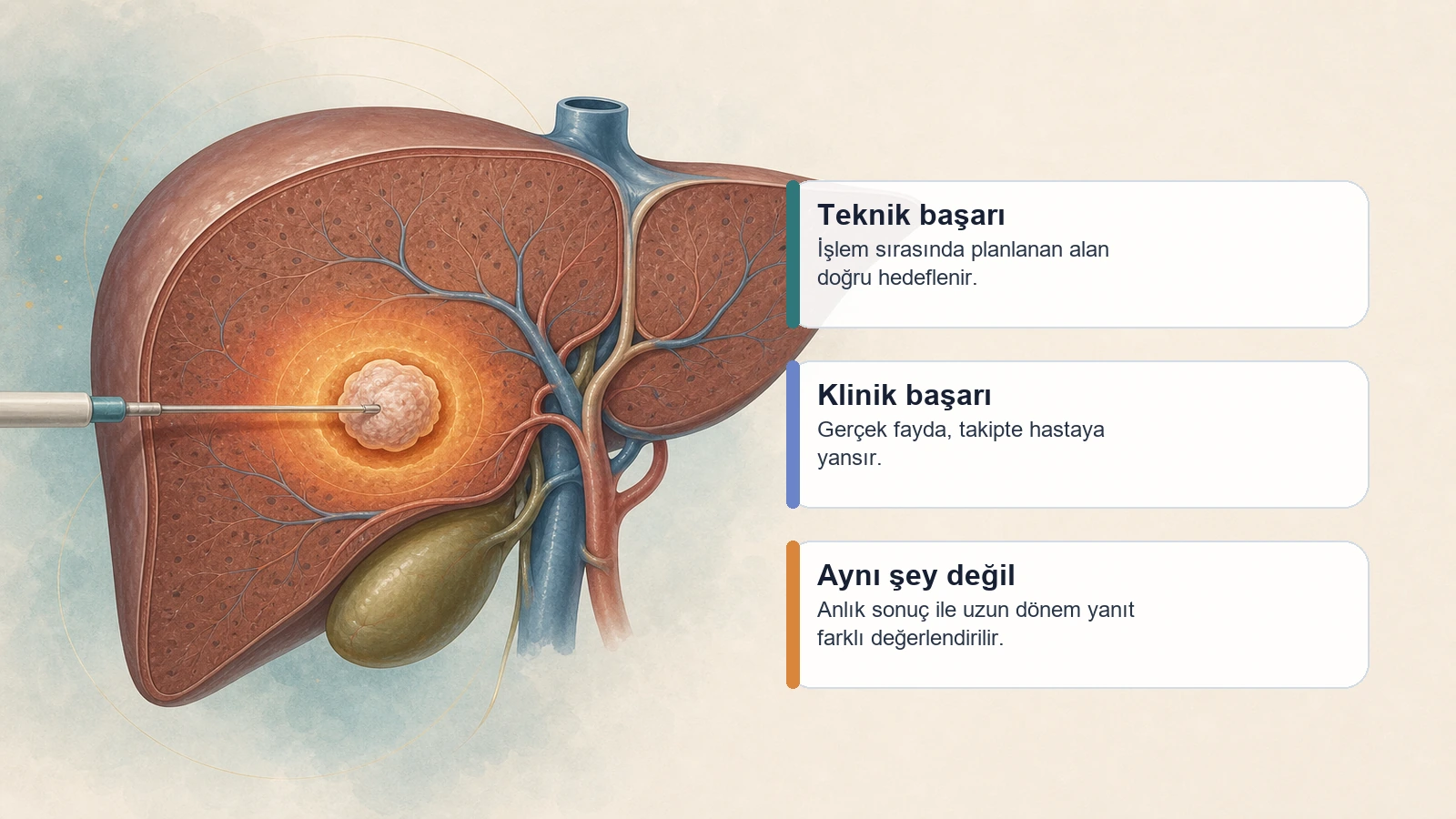 Tümör Ablasyonunda Teknik Başarı ve Klinik Başarı Ne Demektir? için teknik başarı ile klinik başarı arasındaki farkı açıklayan premium medikal görsel